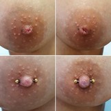 Praxis Workshop - Schlupfwarzen Piercings!
