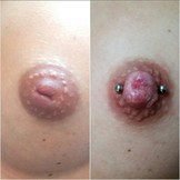 Praxis Workshop - Schlupfwarzen Piercings!