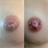 Praxis Workshop - Schlupfwarzen Piercings!