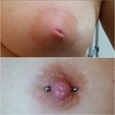 Praxis Workshop - Schlupfwarzen Piercings!