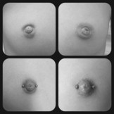 Praxis Workshop - Schlupfwarzen Piercings!